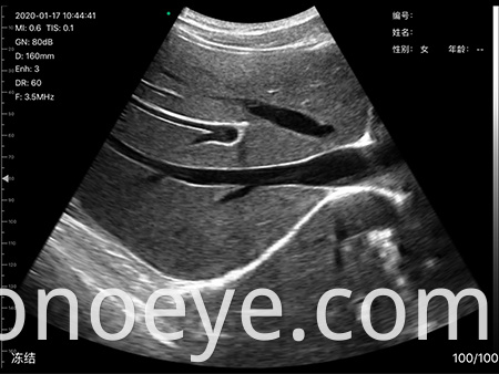 phone type dual heads ultrasound for women